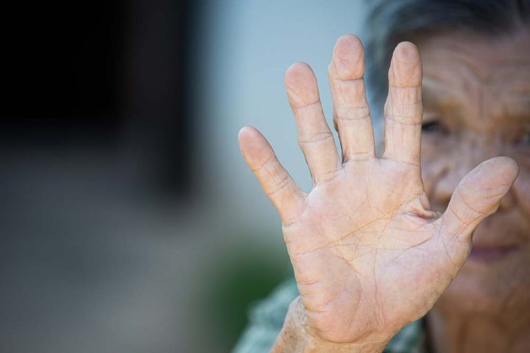 Manjak vitamina D teško je prepoznati, evo koji su prvi znakovi